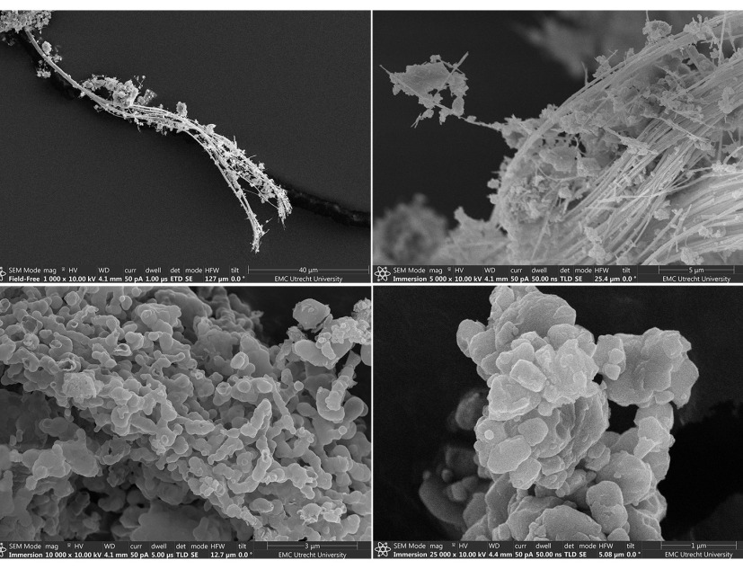 El renacimiento del amianto. 09.ED.15 REDUX por Besley & Spresser. Proceso de descomposición del amianto. Imágenes cortesía de Asbeter