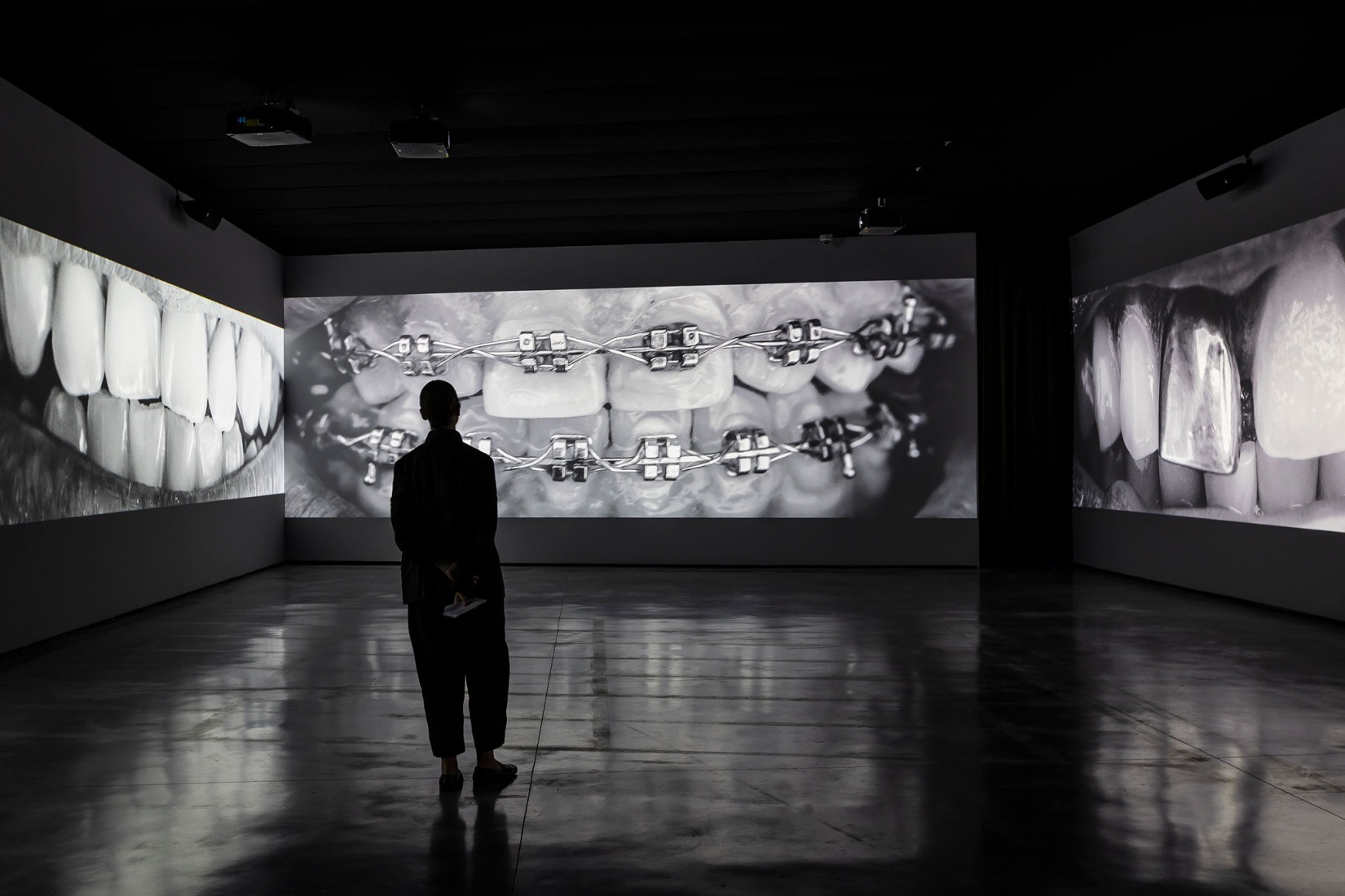 2.068 dientes (2022-2025), Santiago Sierra. Fotografía por Jorge Armestar. Cortesía del Estudio Santiago Sierra y Museo Helga de Alvear.